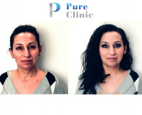 http://pure-clinic.pl/en/dentist-lublin/